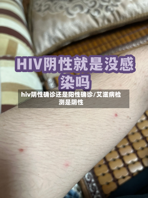 hiv阴性确诊还是阳性确诊/艾滋病检测是阴性-第3张图片