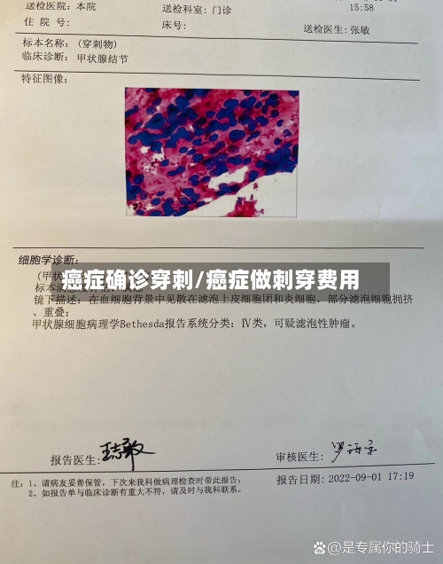 癌症确诊穿刺/癌症做刺穿费用-第2张图片